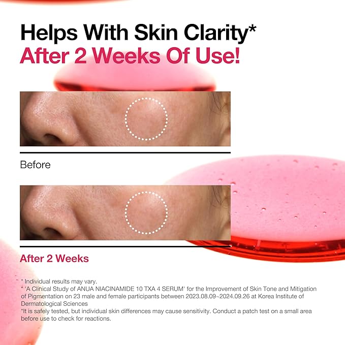 🌟 **ANUA Niacinamide 10 + TXA 4 Serum** 🌟